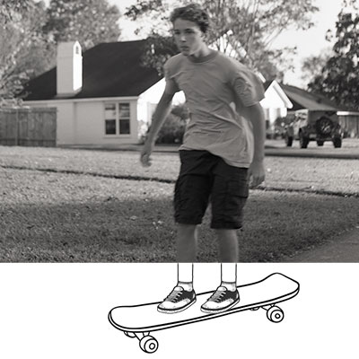 Skateboarder missing legs